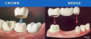 Dental-surgeon-in-ghodbunder-road