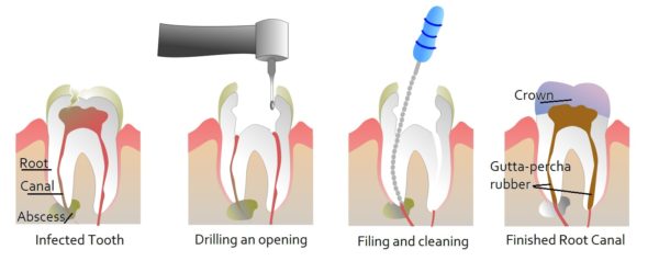 dental-surgeon-in-thane